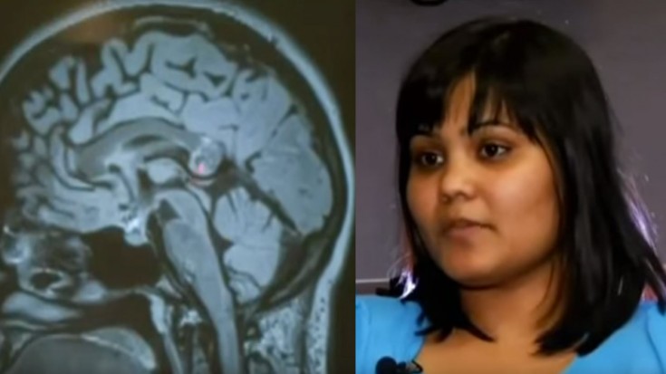 You Won’t Belive What Doctors Found In This Woman’s Brain | Society Of Rock Videos