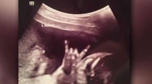 Baby Rocks Out For Ultrasound, And Mom And Dad Are Overjoyed – Guys, This Is Just Too Good