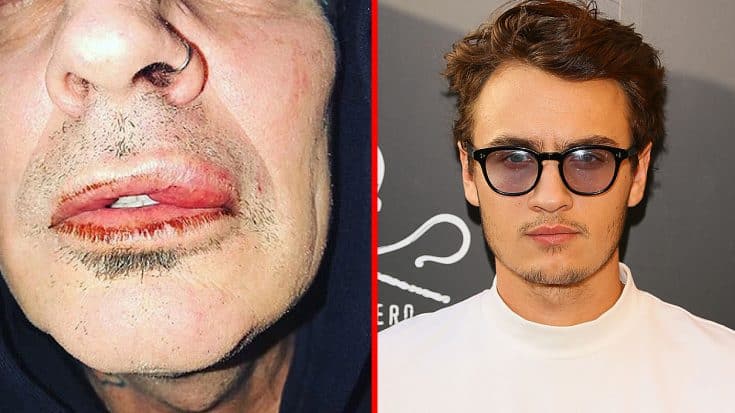 Tommy Lee’s Son Breaks Silence After ‘Assaulting’ His Father… | Society Of Rock Videos
