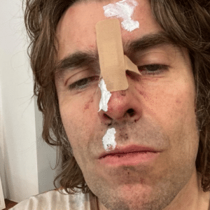Liam Gallagher Fell Off A Helicopter