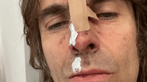 Liam Gallagher Fell Off A Helicopter | Society Of Rock Videos